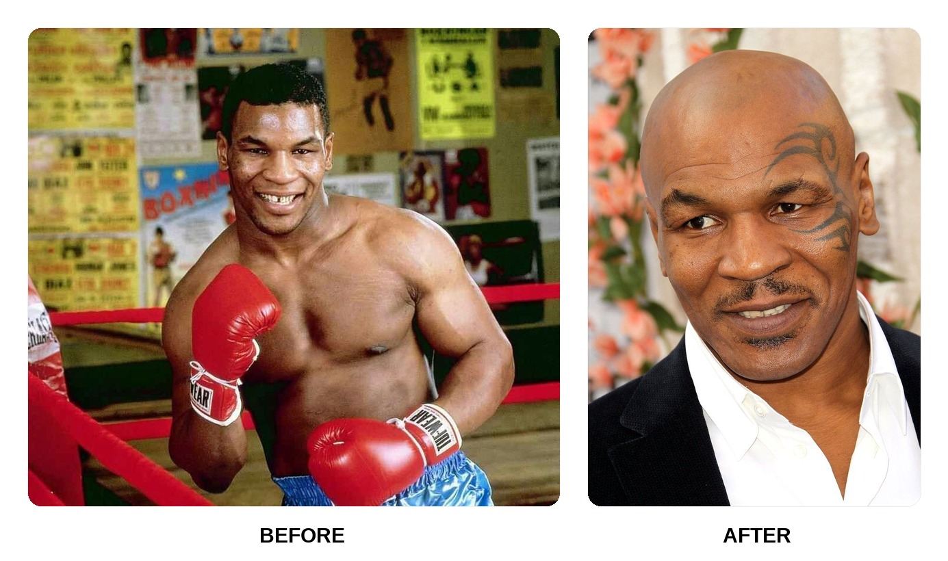Mike Tyson Teeth Before and After: What Happened in His Transformation?