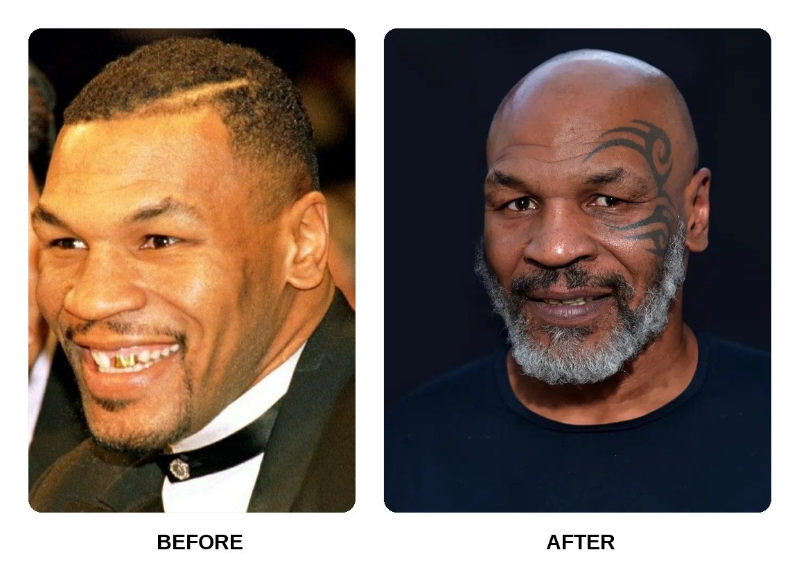 Mike Tyson teeth in his youth