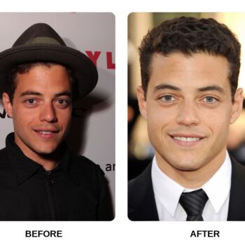 Rami Malek Teeth Before and After: What Happened in His Transformation?